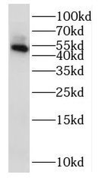 NSUN5 Rabbit Polyclonal Antibody