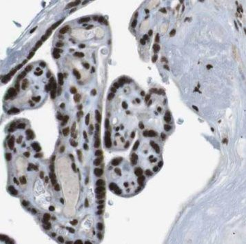 NSUN5 Rabbit Polyclonal Antibody