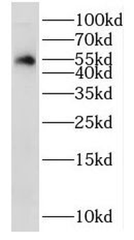 NSUN6 Rabbit Polyclonal Antibody