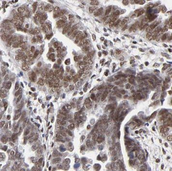NUTF2 Rabbit Polyclonal Antibody