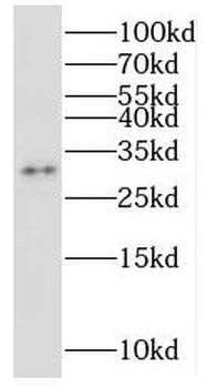 NUBP2 Rabbit Polyclonal Antibody
