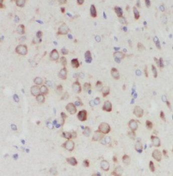 NUDCD3 Antibody