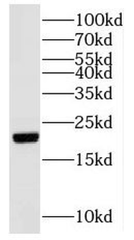 NUDT16 Rabbit Polyclonal Antibody