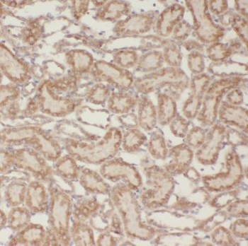 NUDT16 Rabbit Polyclonal Antibody