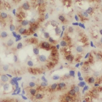 NUDT19 Antibody