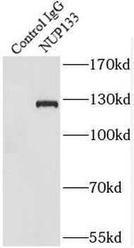 NUP133 Rabbit Polyclonal Antibody