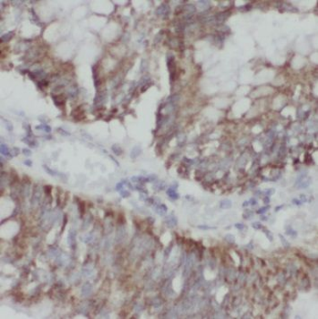 NUP133 Rabbit Polyclonal Antibody