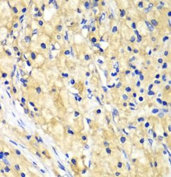 NUP62 Rabbit Polyclonal Antibody