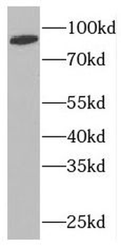 NUP88 Rabbit Polyclonal Antibody