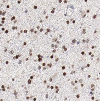 NR4A2 Antibody