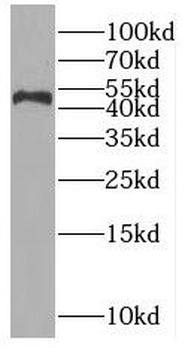 OAS1 Rabbit Polyclonal Antibody