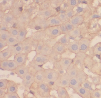 OAS1 Rabbit Polyclonal Antibody