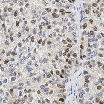 OAS2 Rabbit Polyclonal Antibody