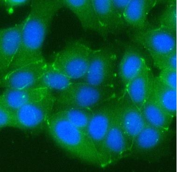 OCLN Rabbit Polyclonal Antibody