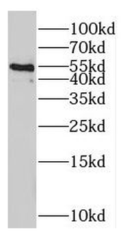 ODC1 Rabbit Polyclonal Antibody