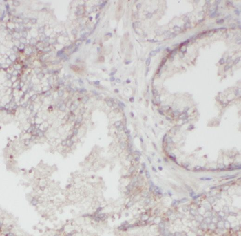 ODC1 Rabbit Polyclonal Antibody