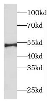 ODC1 Rabbit Polyclonal Antibody