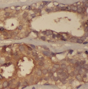 ODF2 Rabbit Polyclonal Antibody