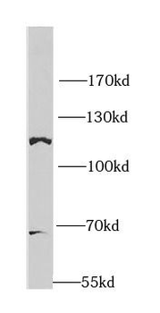 OGT Rabbit Polyclonal Antibody