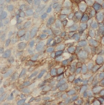 OLFM1 Rabbit Polyclonal Antibody