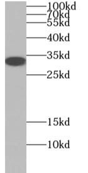OLIG2 Antibody
