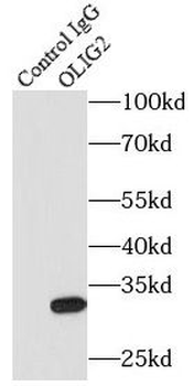 OLIG2 Antibody