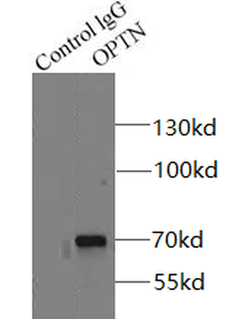 OPTN Antibody
