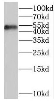 ORC5 Rabbit Polyclonal Antibody
