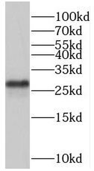 ORC6 Antibody