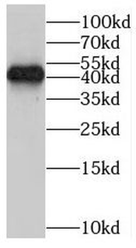 ORM1 Rabbit Polyclonal Antibody