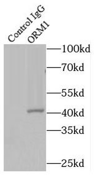 ORM1 Rabbit Polyclonal Antibody