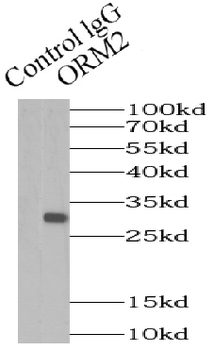 ORM2 Rabbit Polyclonal Antibody