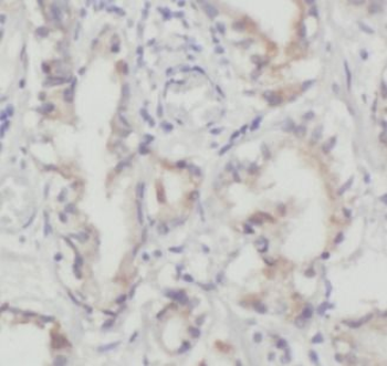 ORM2 Rabbit Polyclonal Antibody
