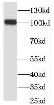 OSBPL3 Rabbit Polyclonal Antibody