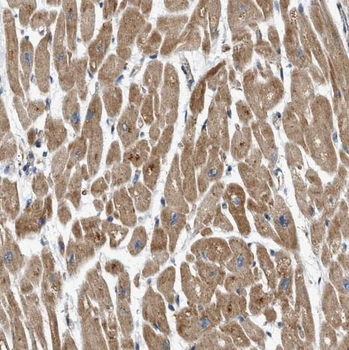 ATP5PO Rabbit Polyclonal Antibody