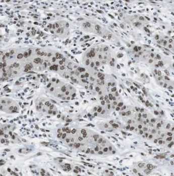 OSGEP Rabbit Polyclonal Antibody