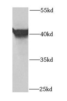 OSGEPL1 Rabbit Polyclonal Antibody