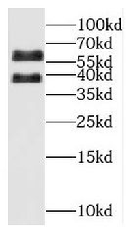 OSGIN1 Rabbit Polyclonal Antibody