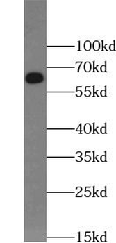 SPP1 Rabbit Polyclonal Antibody