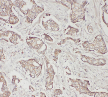 SPP1 Rabbit Polyclonal Antibody