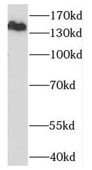 OTUD4 Rabbit Polyclonal Antibody