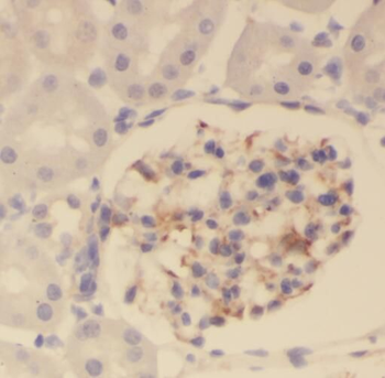 OTUD4 Rabbit Polyclonal Antibody