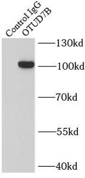 OTUD7B Rabbit Polyclonal Antibody