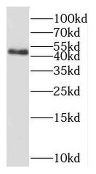 OXSM Rabbit Polyclonal Antibody