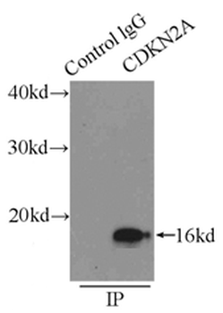 CDKN2A Rabbit Polyclonal Antibody