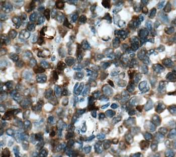 CDKN2A Rabbit Polyclonal Antibody