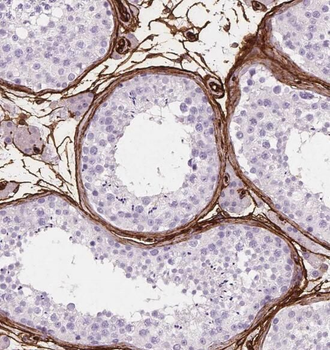 P2RY1 Rabbit Polyclonal Antibody