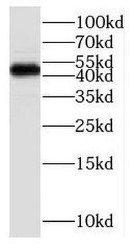P2RY6 Rabbit Polyclonal Antibody