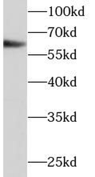 P4HA1 Rabbit Polyclonal Antibody
