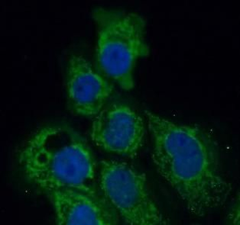 P4HA1 Rabbit Polyclonal Antibody
